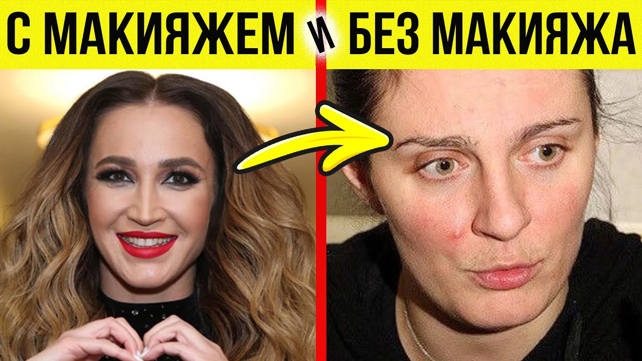 Умойся! Как на самом деле выглядят наши звезды (ЖУТЬ)