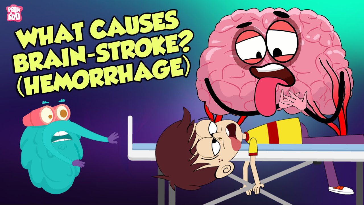 What Causes A Brain Stroke? | Brain Attack | The Dr Binocs Show | Peekaboo Kidz
