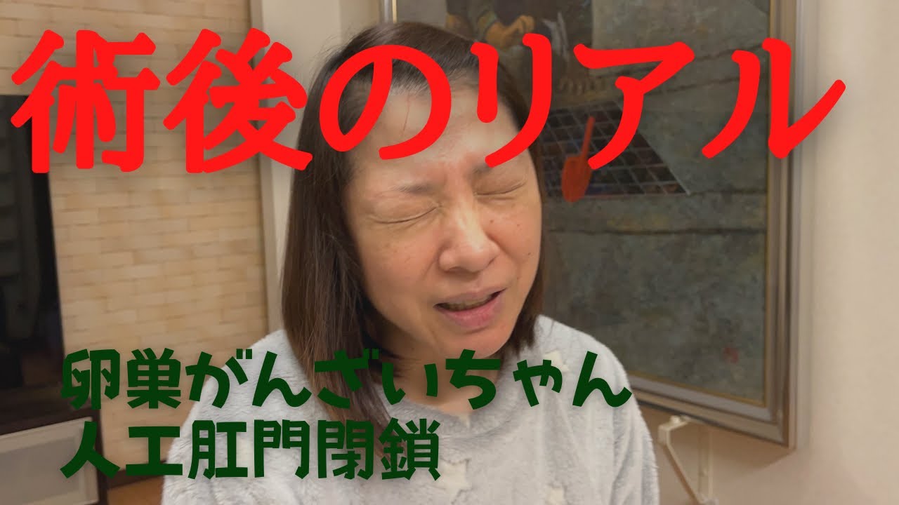 【ストーマ閉鎖後】人工肛門閉鎖術、3年前のリアルを初公開！