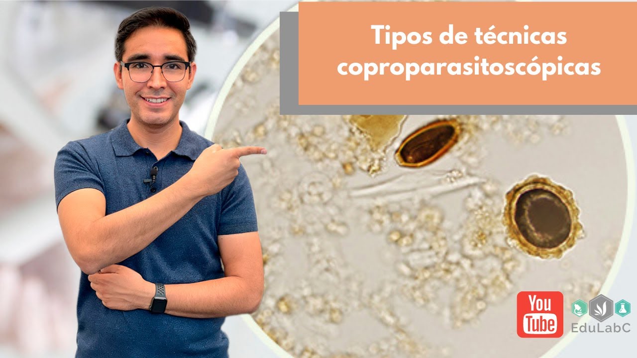 🔬 Laboratorio Clínico: Técnicas coproparasitoscópicas 💩  | 👨🏻‍🏫  Bloque Informativo EduLabC