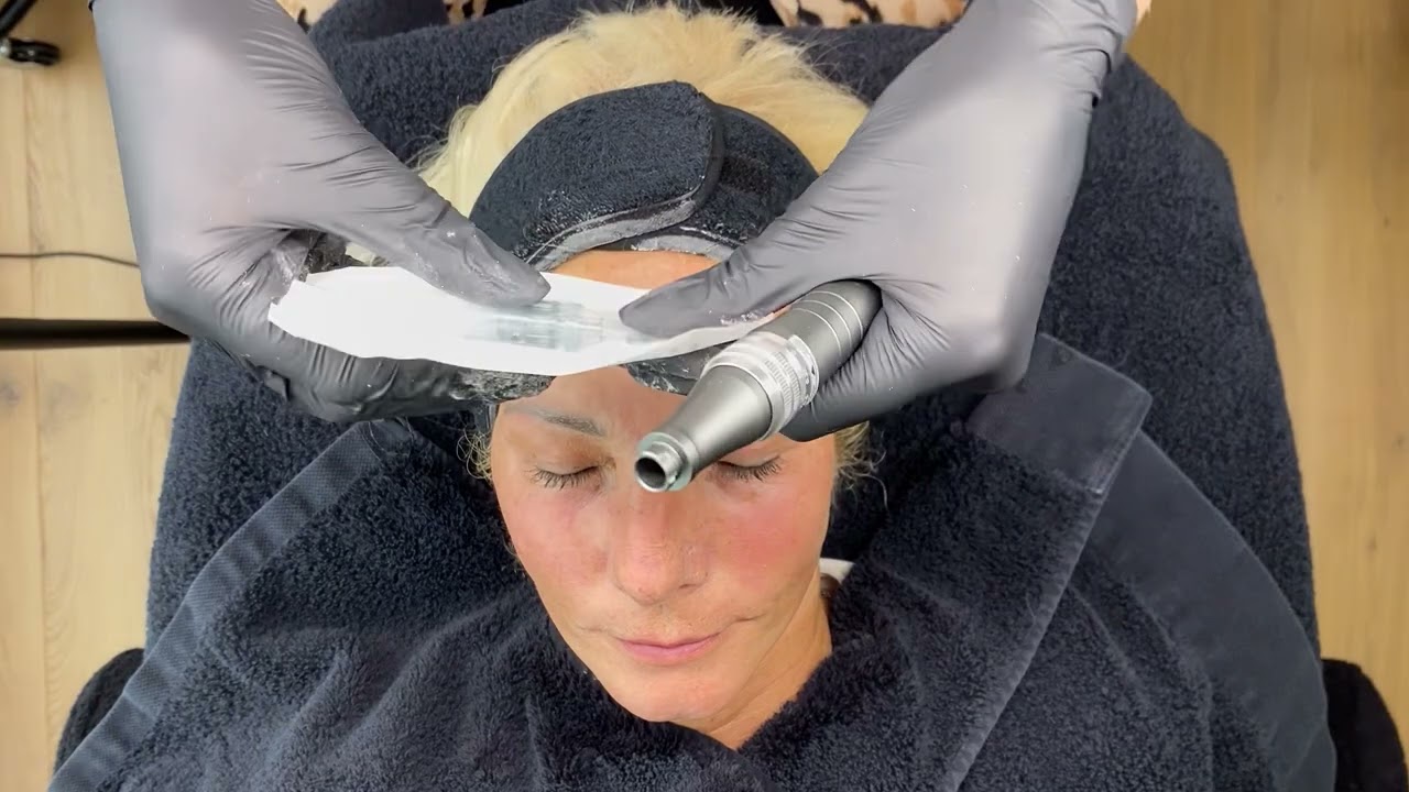 VIVE Huidtherapie MicroVitamin behandeling 🍋