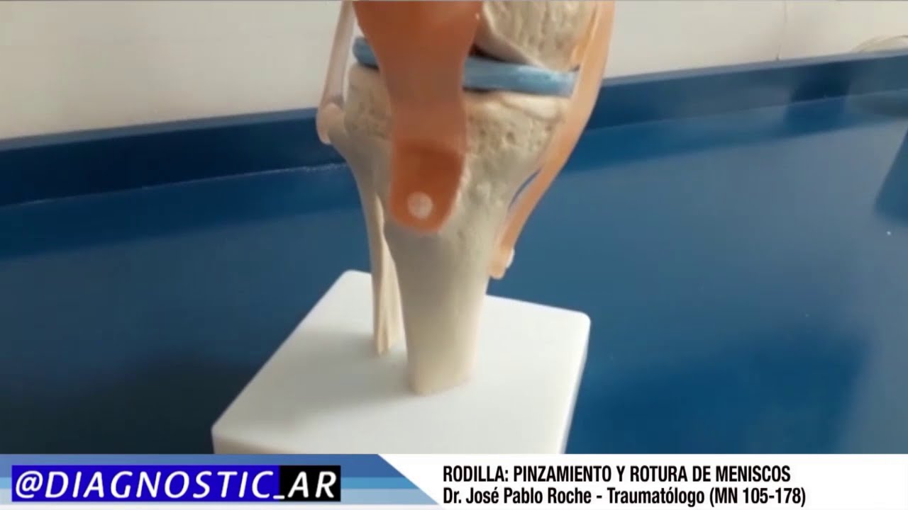 RODILLA PINZAMIENTO Y ROTURA DE MENISCOS