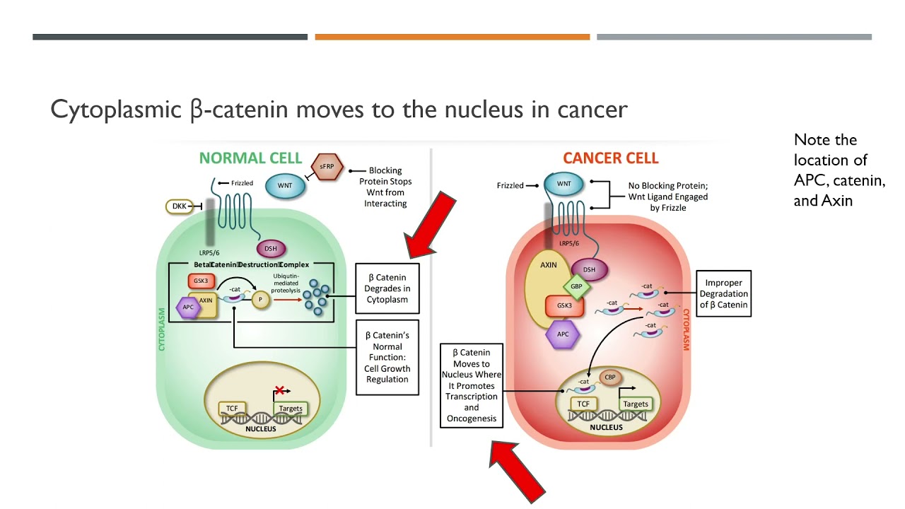Desmoid Tumors Extended Diagnostic Panel
