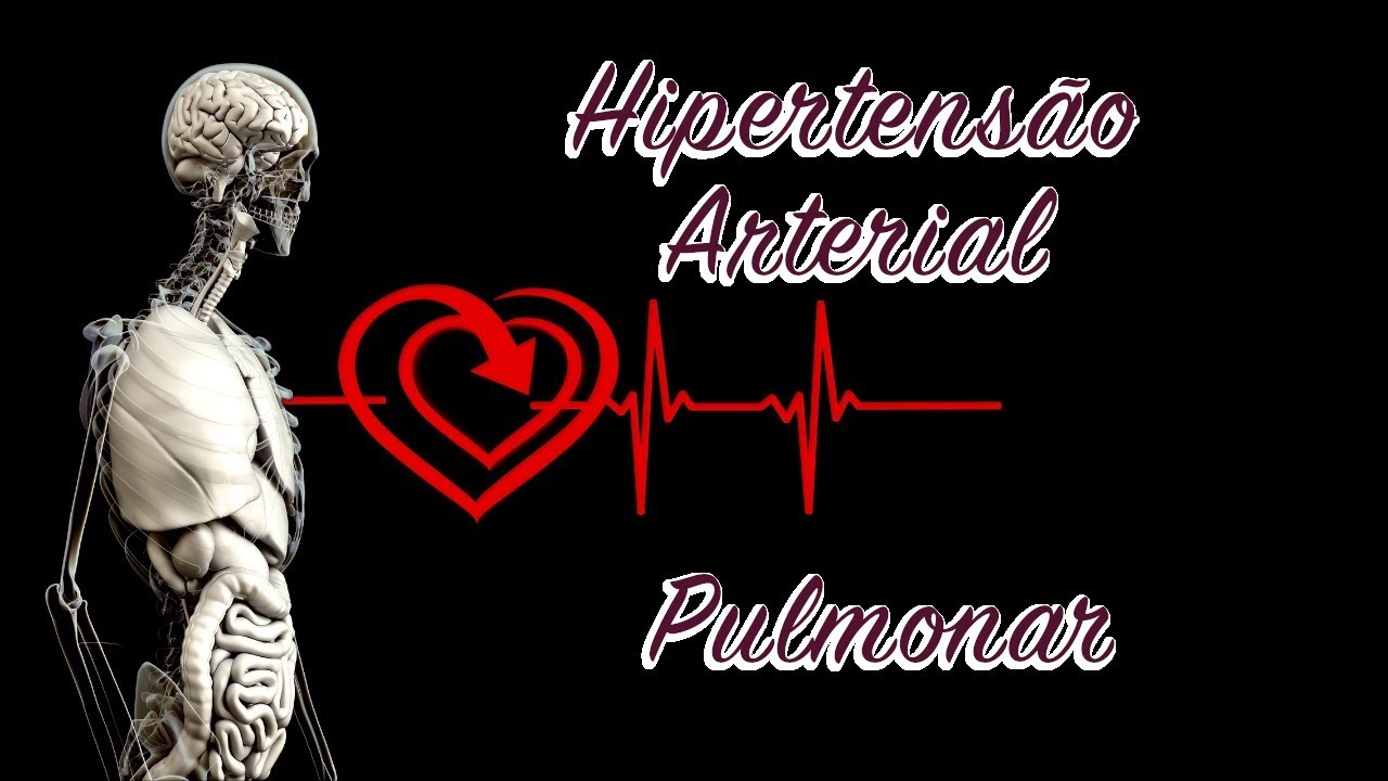Hipertensão Pulmonar
