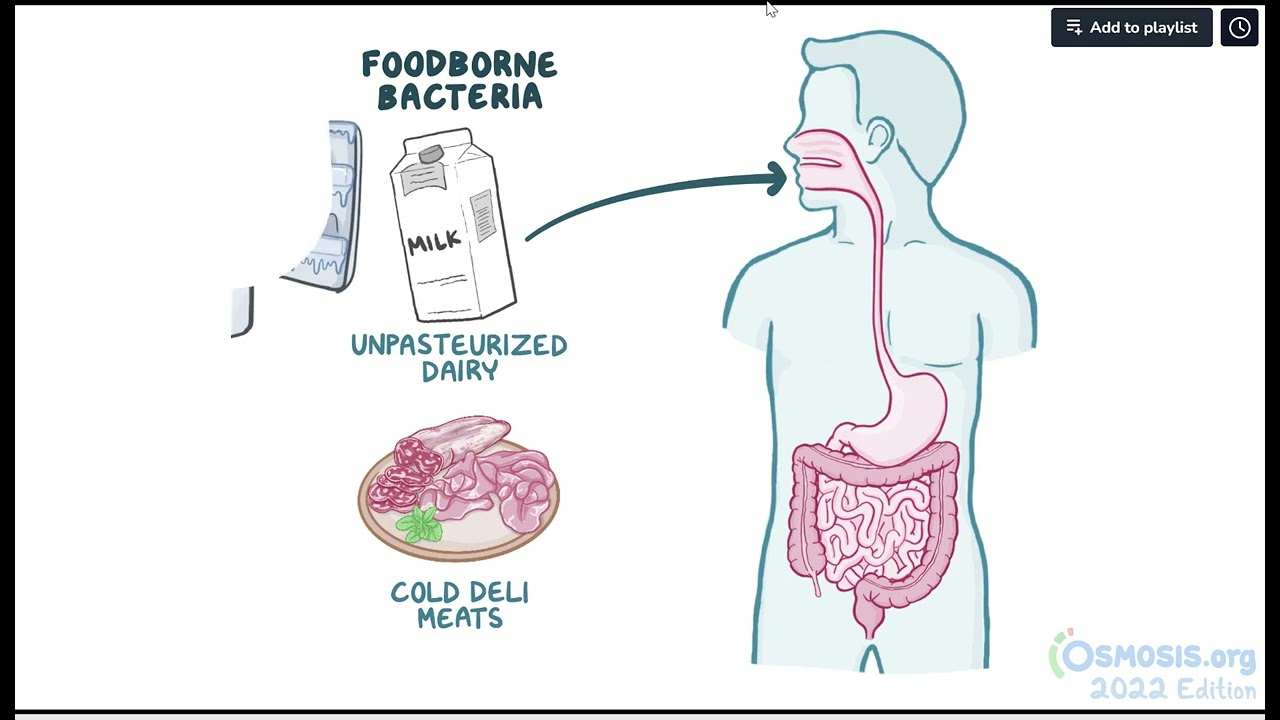 Listeria monocytogenes