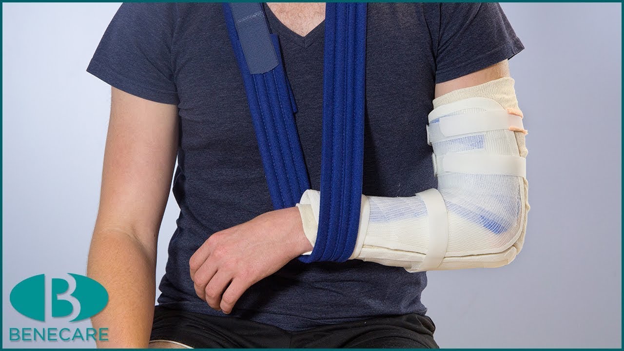 How To Apply a Elbow Drop Out Splint