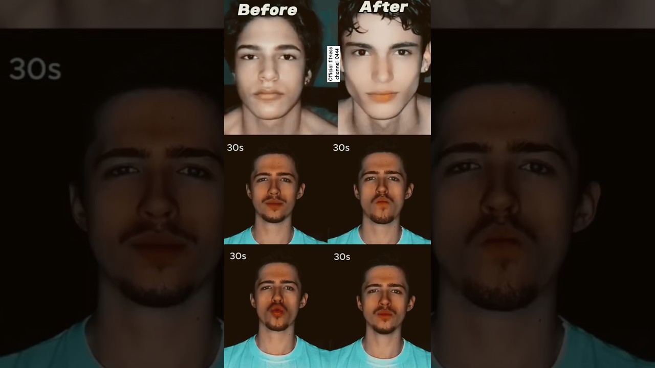 How to Get a Defined Jawline (Without Mewing or Exercises)