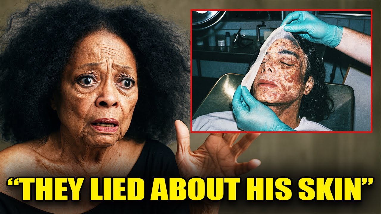 Diana Ross Finally Reveals the Dark Truth Behind Michael Jackson's Skin – It’s What Killed Him?