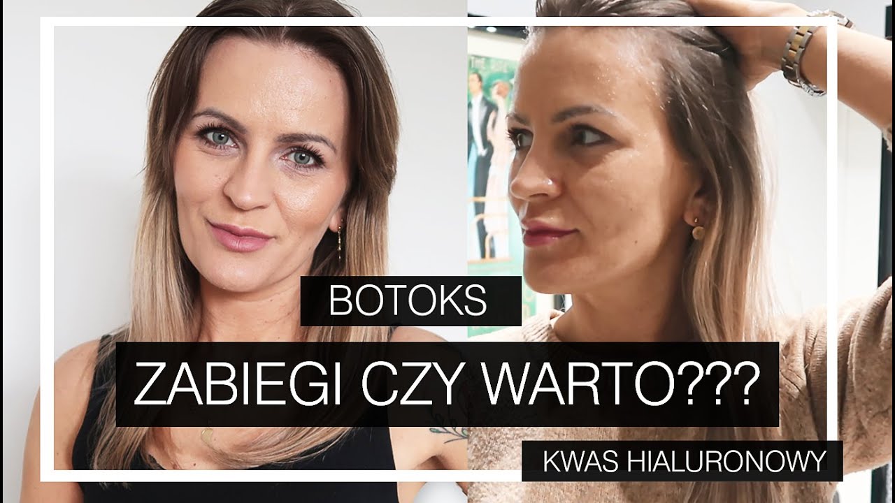 ZABIEGI CZY WARTO??? Botoks i kwas hialuronowy