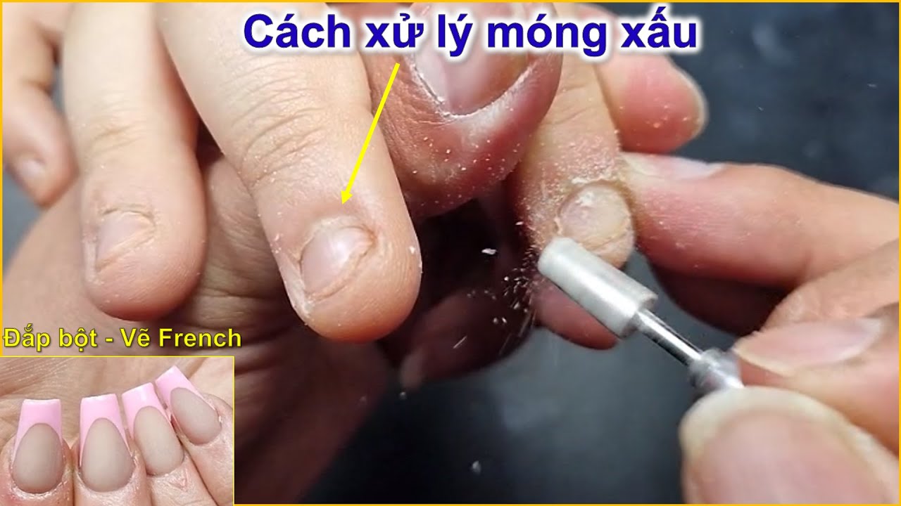 Share how to deal with bad nails - Apply French powder | Diep Nguyen