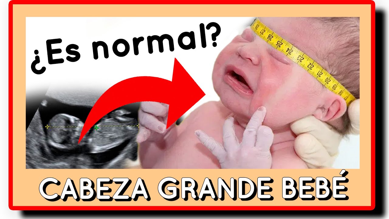 🤰 MI BEBÉ tiene la cabeza GRANDE 💥  ¿es normal?
