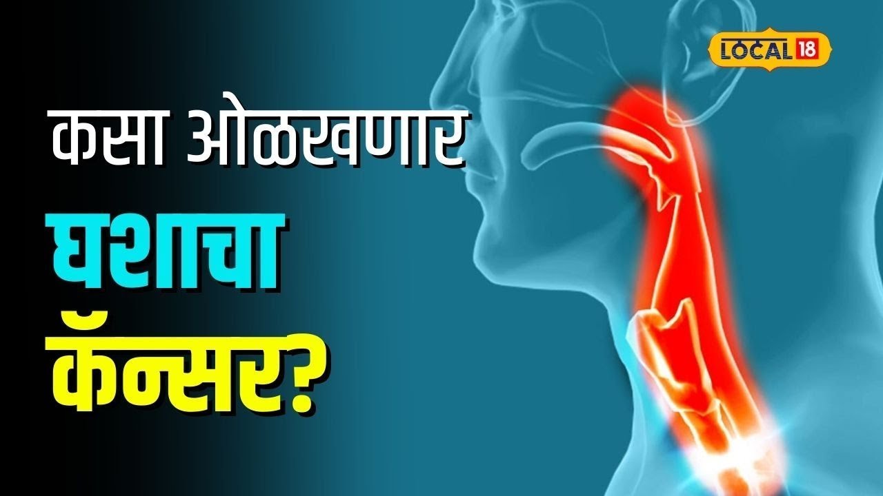 Throat Cancer | घशात सारखा कफ राहतोय? वेळीच सावध व्हा, लगेच डॅाक्टरांशी करा संपर्क | #local18