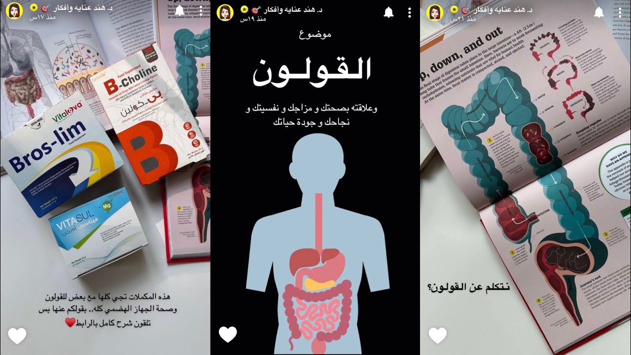 موضوع القولون وعلاقته بصحتك ومزاجك ونفسيتك ونجاحك وجودة حياتك | د.هند عنايه وأفكار 🎯
