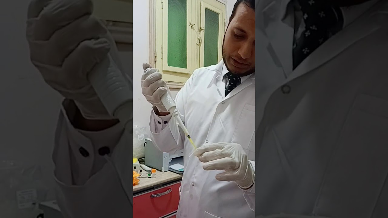 HBA1C BIOMED TURBI شغل عينه
