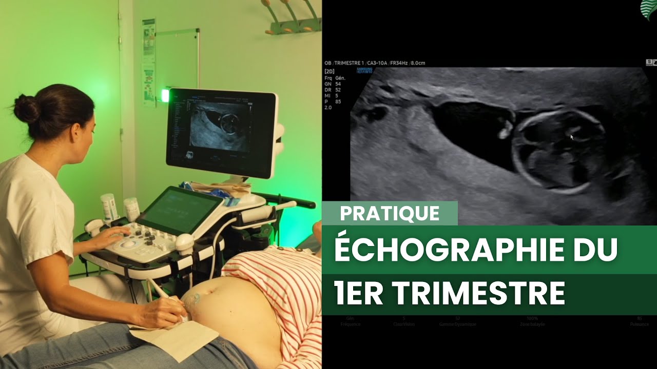 Échographie du 1er trimestre : Démonstration et Formation Pratique