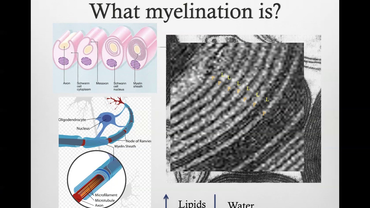 Basics of Clinical MRI in Neuropediatrics: Part 1
