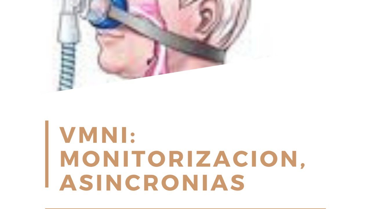 VMNI, monitorizacion, asincronias. N González, Alex Pintos