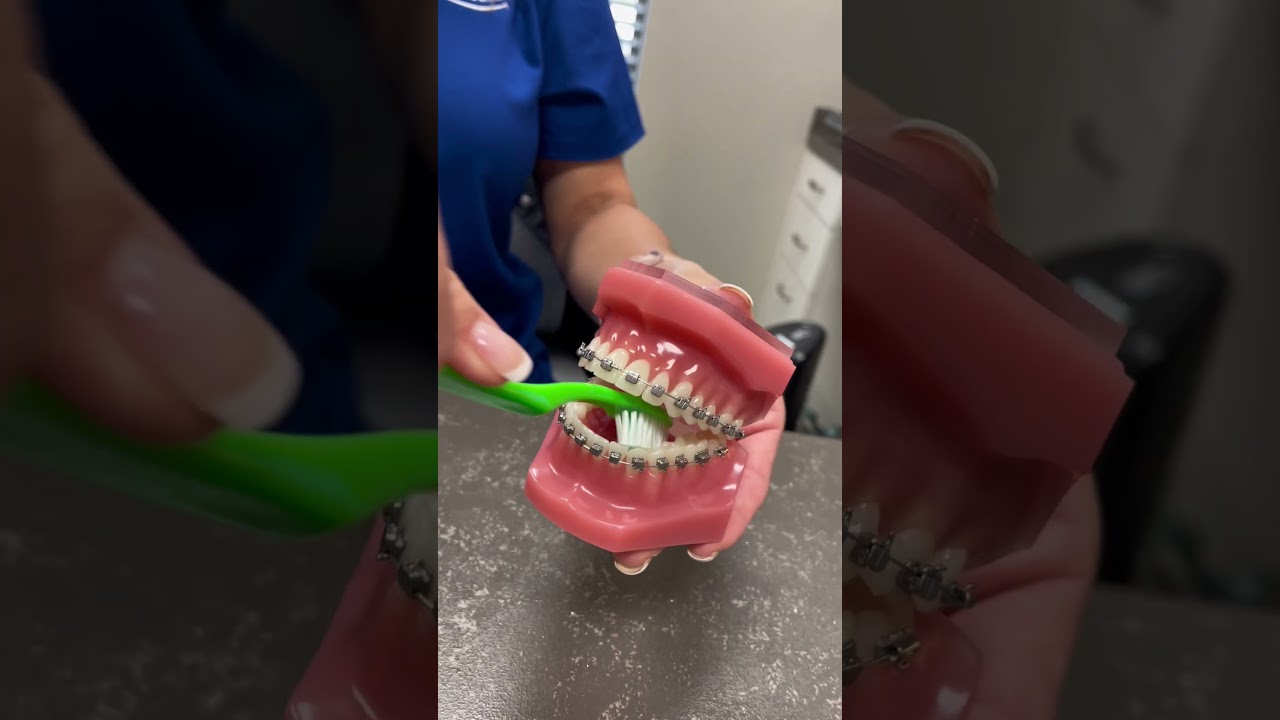Tips for brushing your teeth with braces #dentalcare