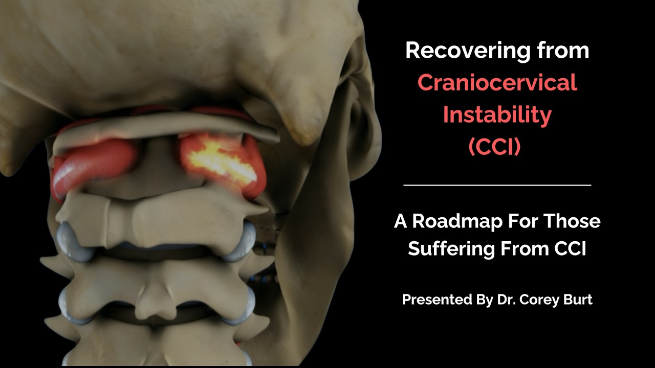 Roadmap to Recovering from Craniocervical Instability (CCI) with Dr. Corey Burt
