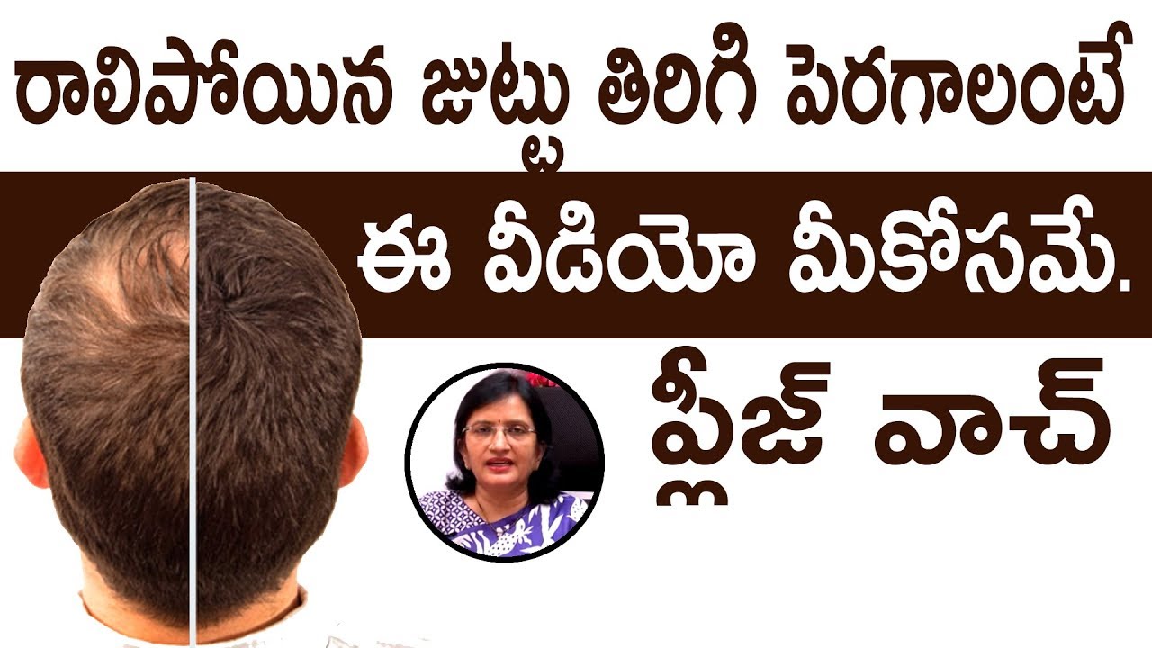 Stress is the Only Reason For Hair Fall? l Reasons For Hair-fall and Tips For Regrowth  l Hai TV