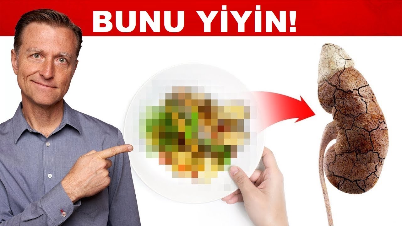 Böbrek Zehirlenmesi Tedavisi İçin En iyi Yiyecek | Dr.Berg Türkçe