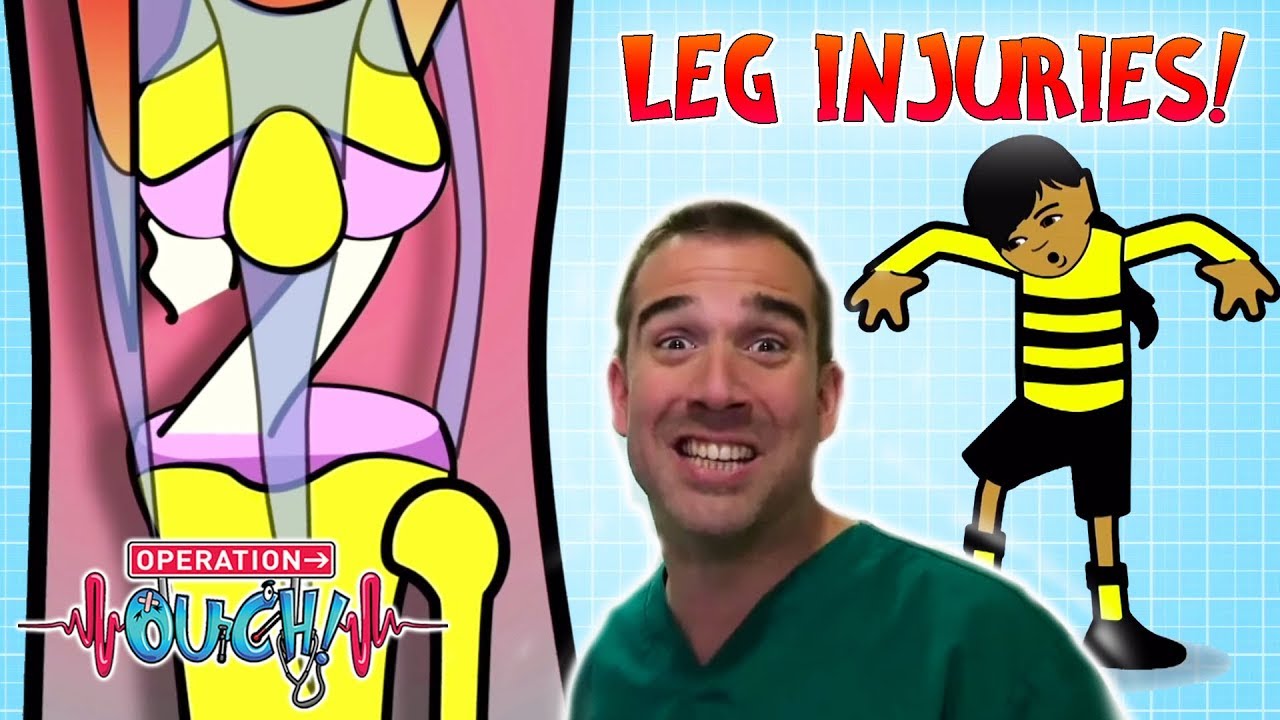 Leg Injuries! | Ouch Alert | Operation Ouch | Science for Kids