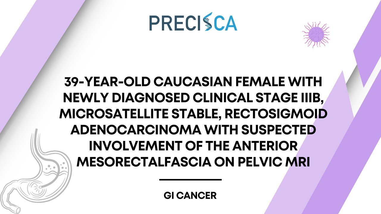 Expert Cancer Panel: Stage IIIB, MSS, rectosigmoid adeno ca w/ involvement of mesorectal fascia