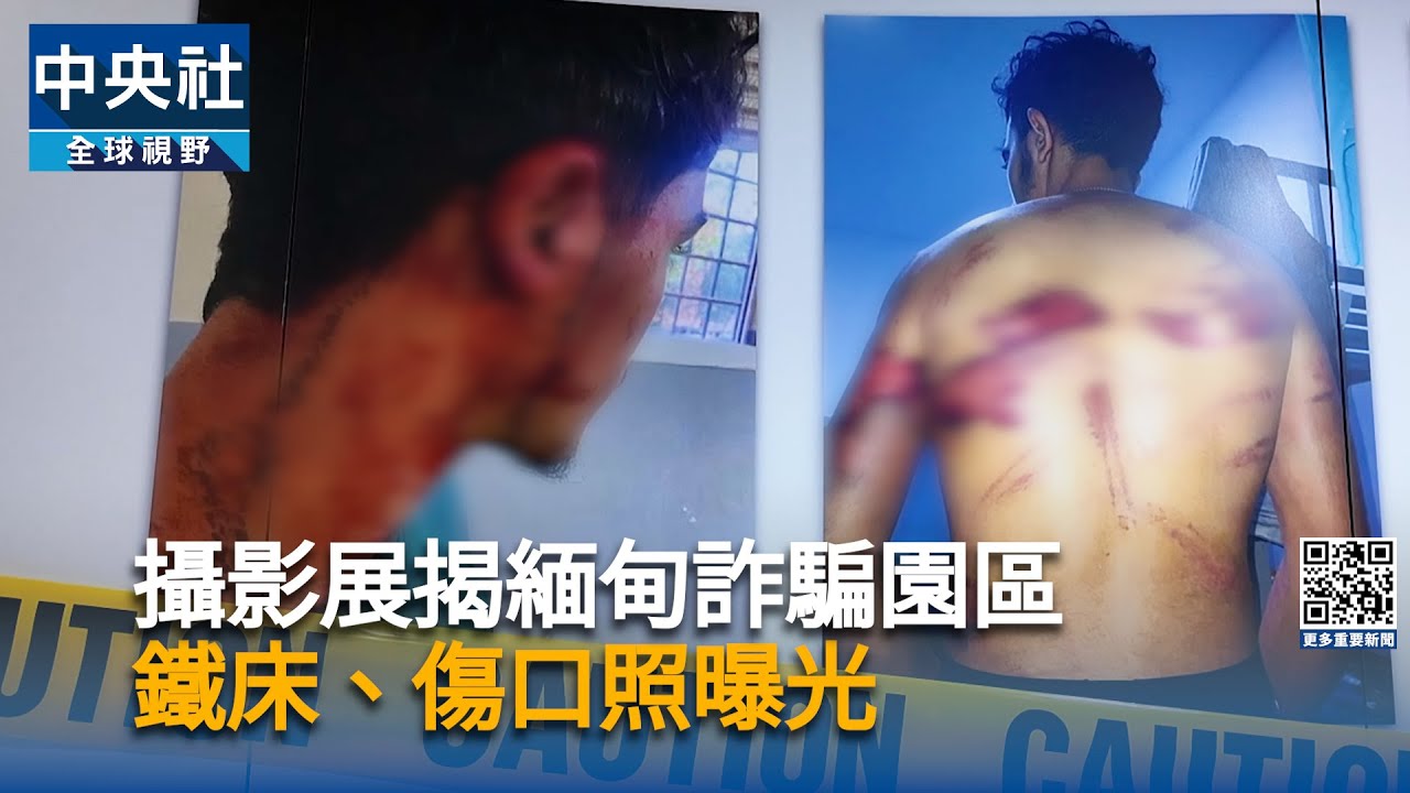 人間煉獄！曼谷展揭緬甸詐騙園區慘況　鐵床、傷口照曝光｜中央社影音新聞