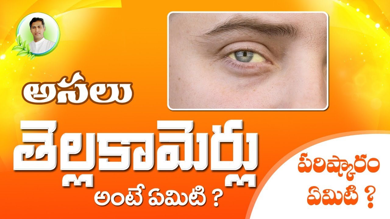 Jaundice | Symptoms, Causes & Treatment | Manthena Satyanarayana Raju Videos