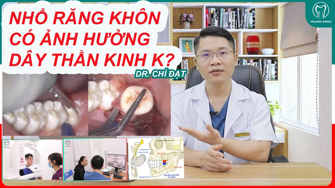 Nhổ răng khôn có ảnh hưởng dây thần kinh không?