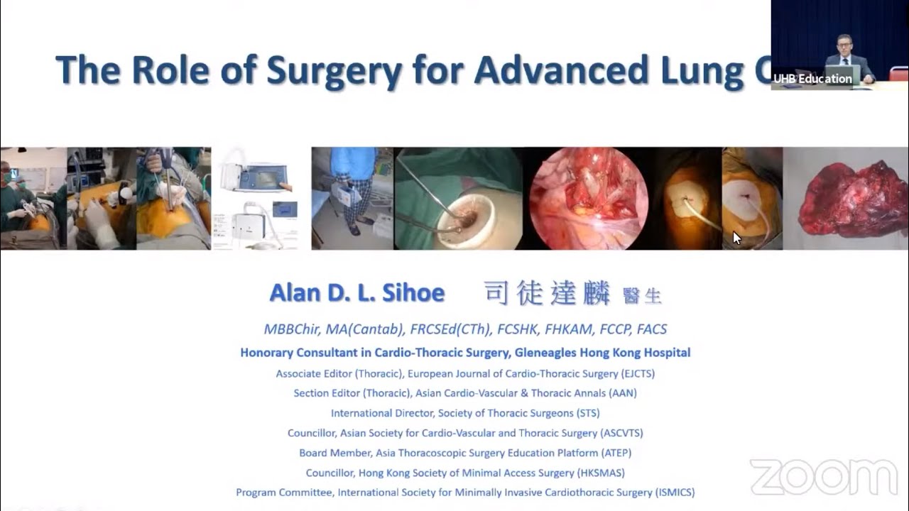 The Role of Surgery for Advanced Lung Cancer: Birmingham Review 2021