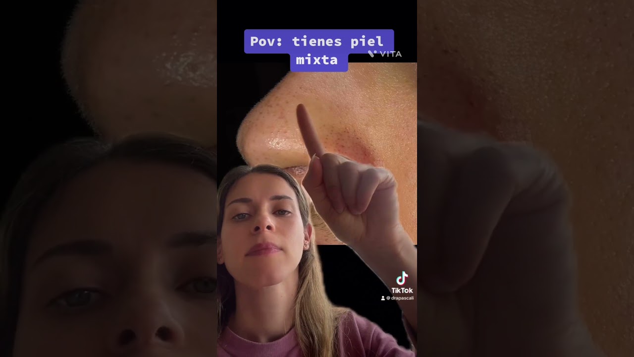 Tienes piel mixta #shortamv