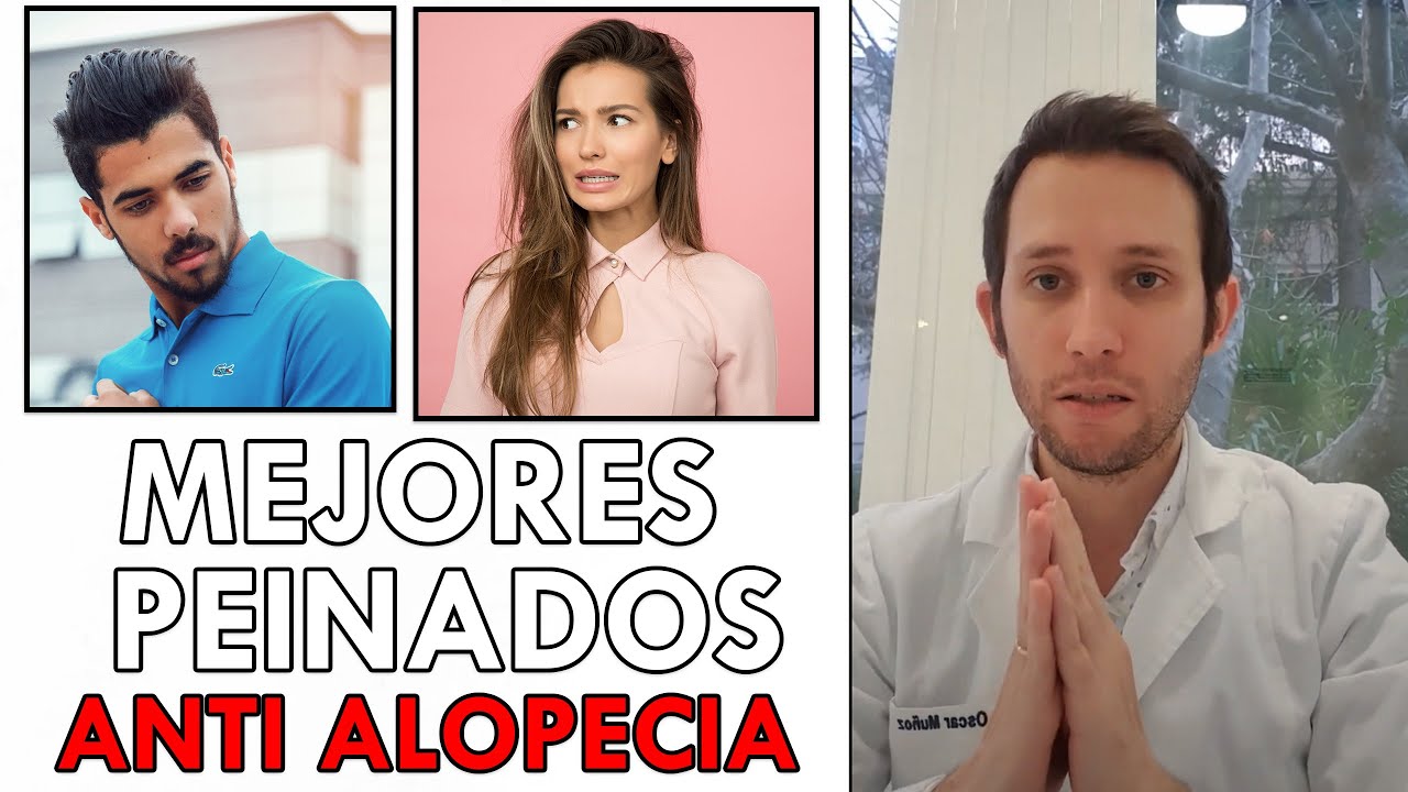 MEJORES PEINADOS para EVITAR la PERDIDA de PELO