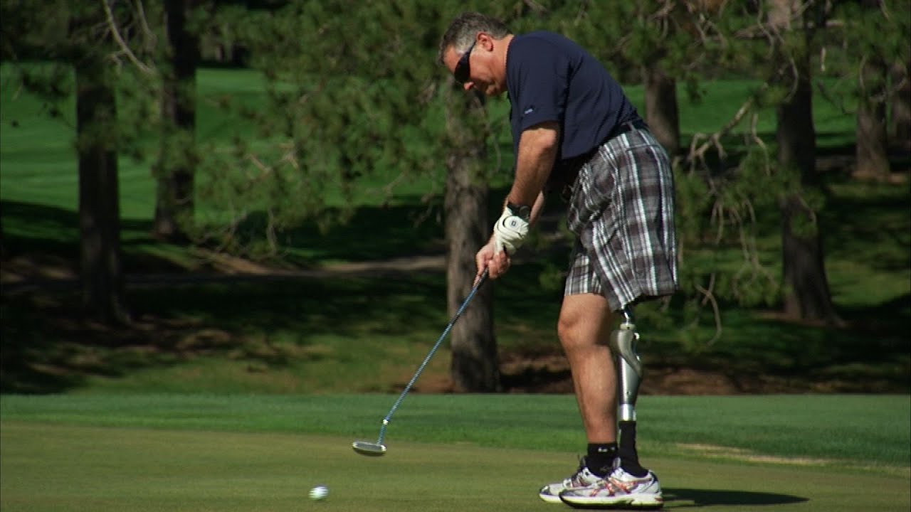 Golf after Hemipelvectomy - Mayo Clinic