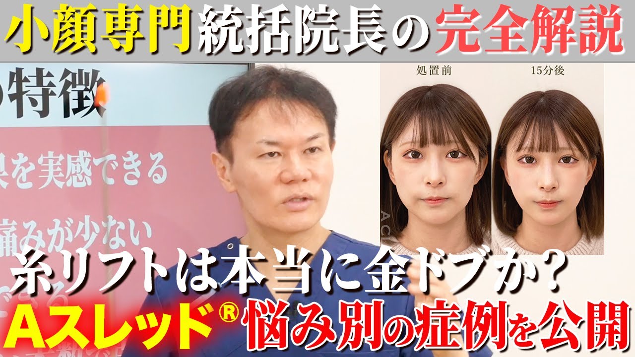 糸リフトって本当に意味ある？Aスレッド&reg;を勧める理由を美容外科歴30年の医師が完全解説