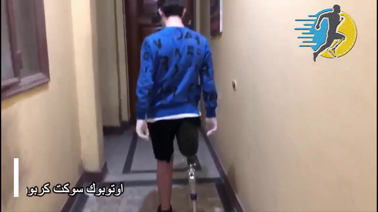 طرف صناعي فوق الركبة الماني سوكت كربون لينر اوتوبوك