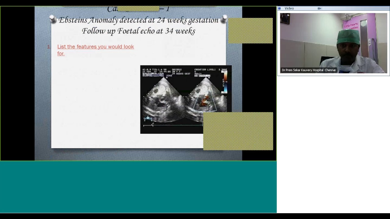 Ebsteins Quiz by Dr Prem Sekar
