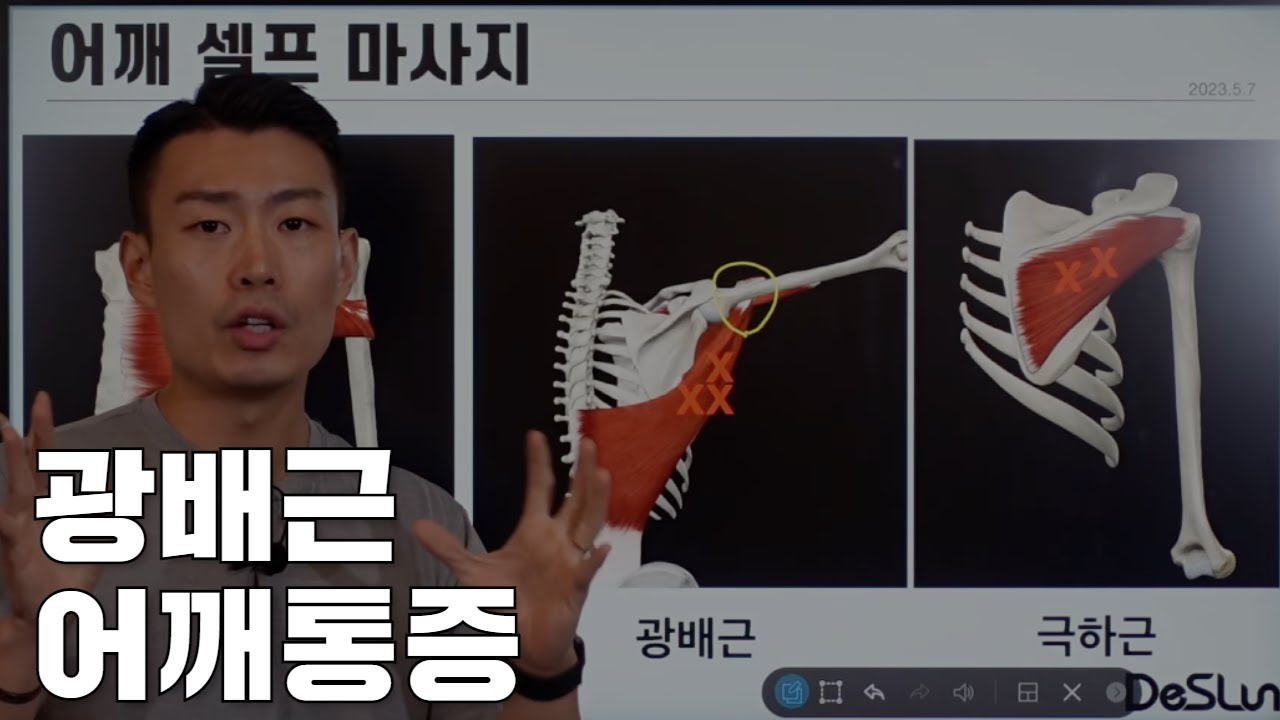 광배근 때문에 어깨통증이 생길 수 있다고요?