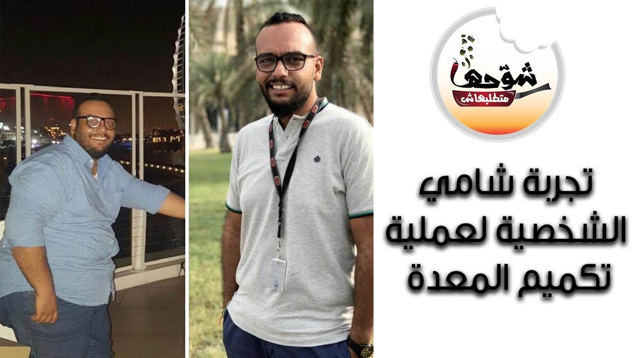 شوحها متطلبهاش -تجربة شامي مع عملية تكميم المعدة -والاجابة على كل الاسئلة