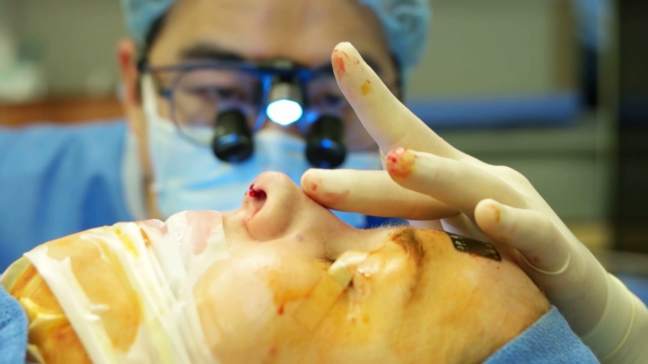 Rhinoplasty Nose Surgery Patient Testimonial - Carli | Dr. Eugene Kim, Plastic Surgeon Beverly Hills