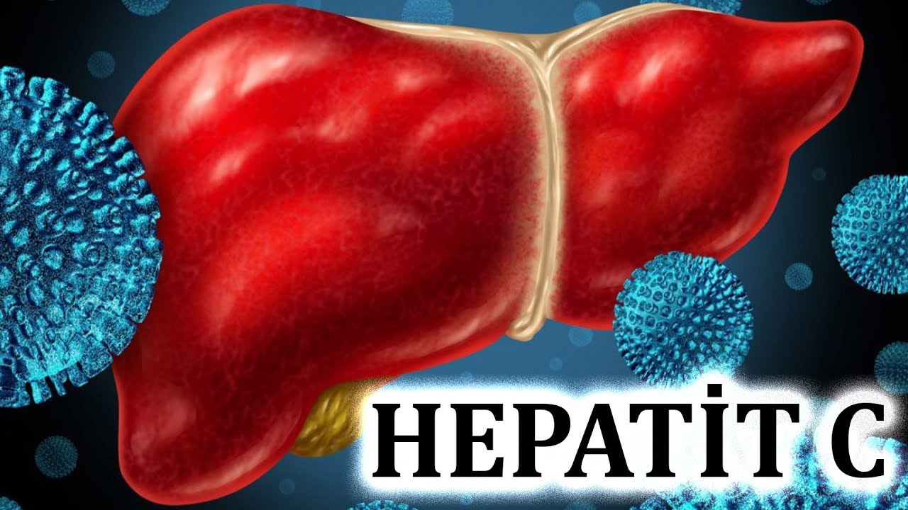 Hepatit C necə müalicə olunur?