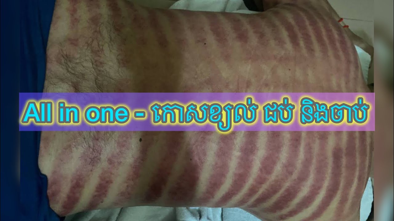 My clients with variety of massage - 3 in 1