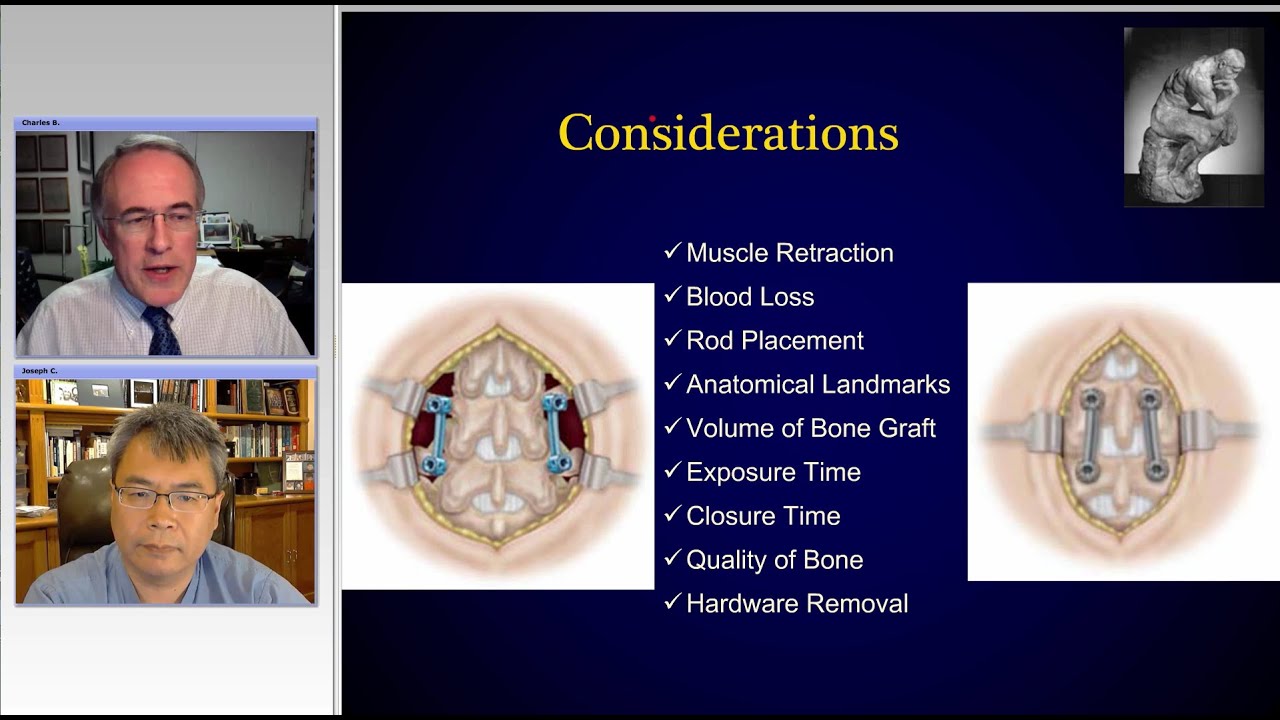Sagittal Imbalance and Minimally Invasive Spine Surgery (Preview)