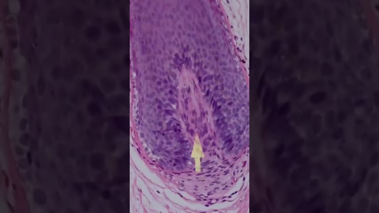 Hair follicle root under the microscope. #histology #pathology #usmle #hair #science #doctor