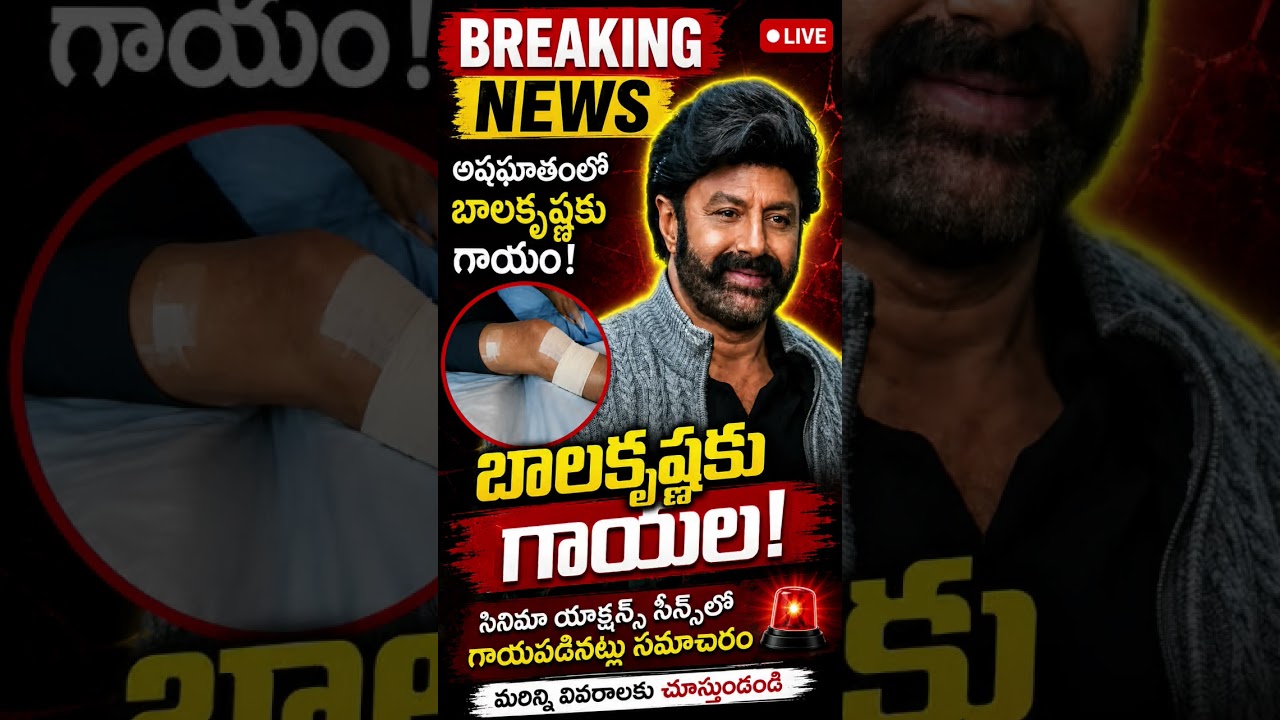 Major injury to actor Balakrishna #reels #viral #trending #news #ytshorts #balayya