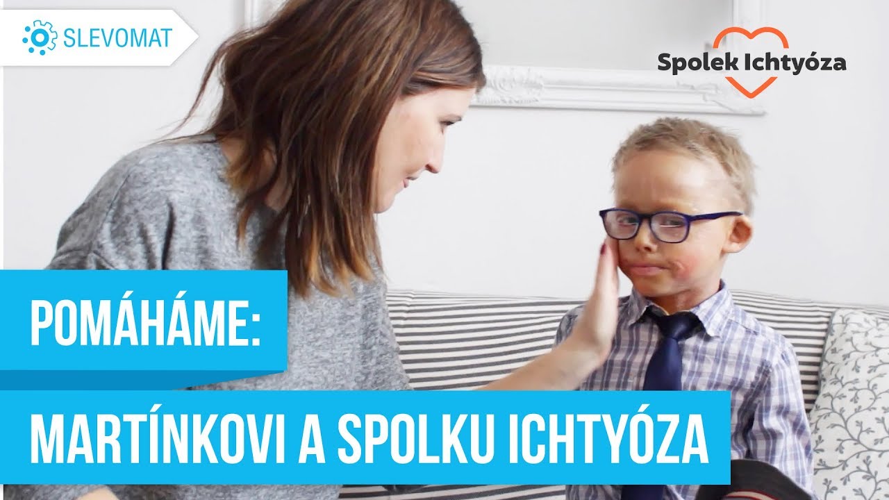 Pomáhejte s námi: Martínkovi a Spolku Ichtyóza