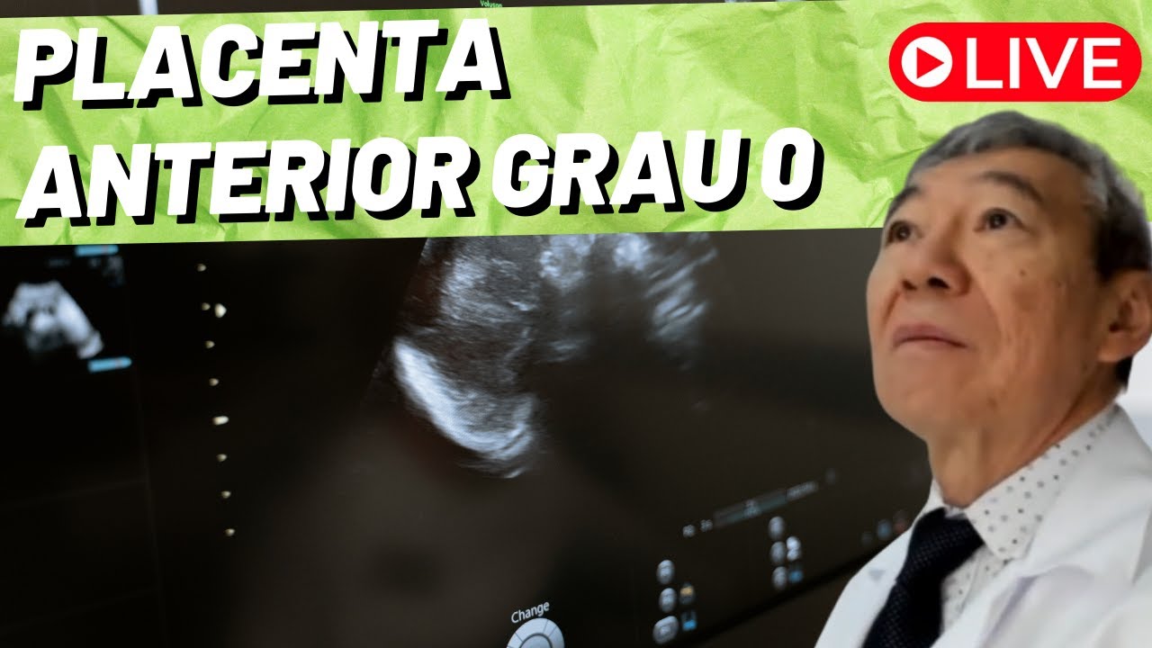 AO VIVO: PLACENTA ANTERIOR GRAU O!