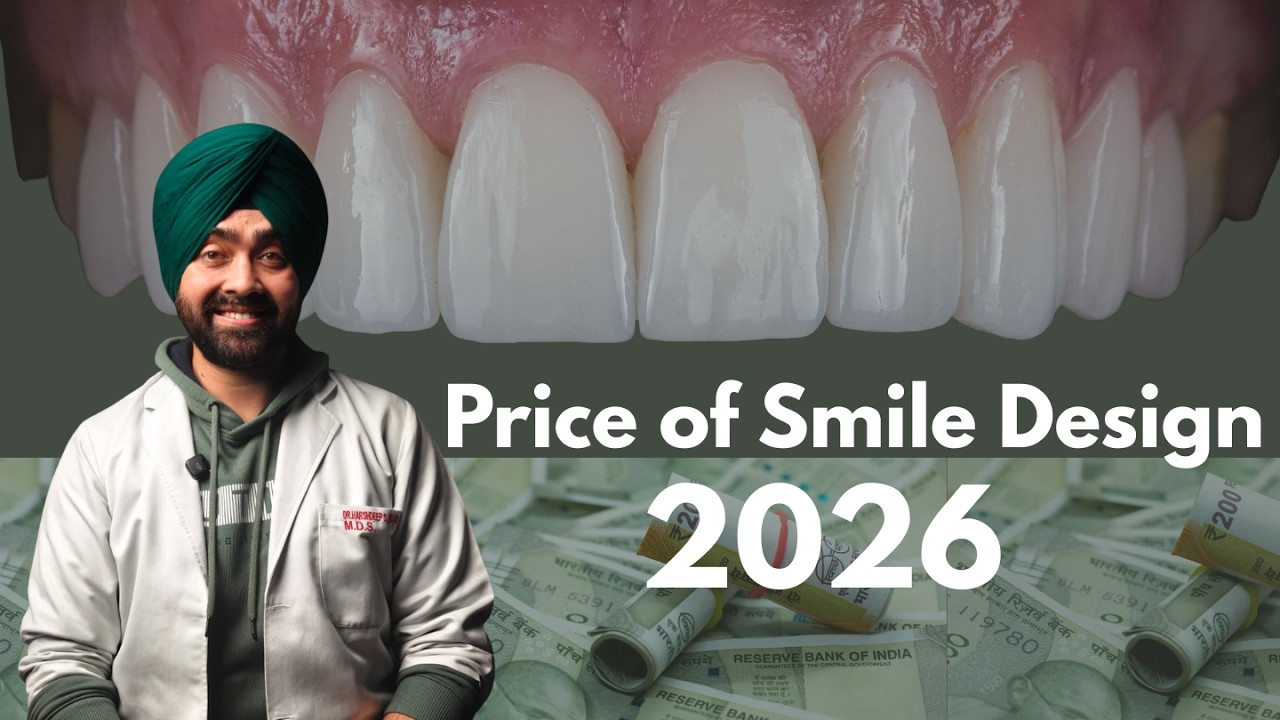 Smile Makeover Cost in India (2026) | Real Price Breakdown by a Dentist