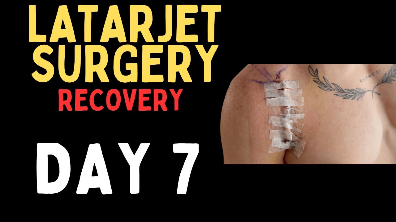 Latarjet surgery RECOVERY Day 7 | Shoulder Rehab Exercises + Scar & Bandage Care