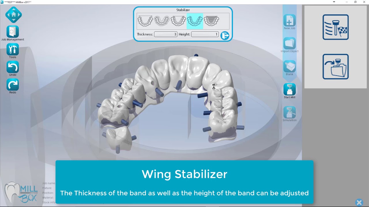 2017 MillBox Bridge Stabilizers Eng
